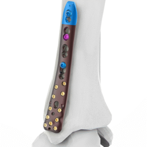 2.7-3.5MM VARIXIS MEDIAL DISTAL TIBIA
  PLATE  